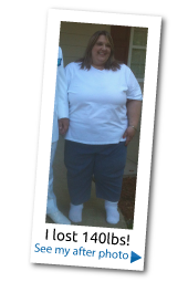 I lost 140 pounds on ITG Diet extreme-weight-loss